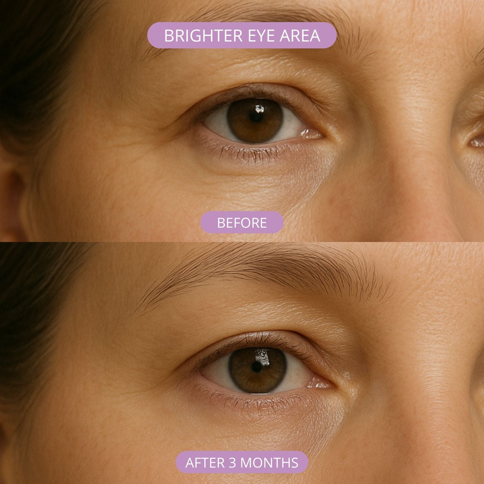 Lumnea MenoGlow 4-in-1 Anti-Aging Device